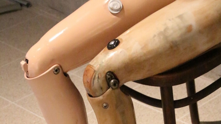 Zdjęcie protez nóg, ugiętych do siedzenia. Ujęcie od łydek do ud. Prawa noga plastikowa, lewa drewniana. W okolicy kolan śruby.